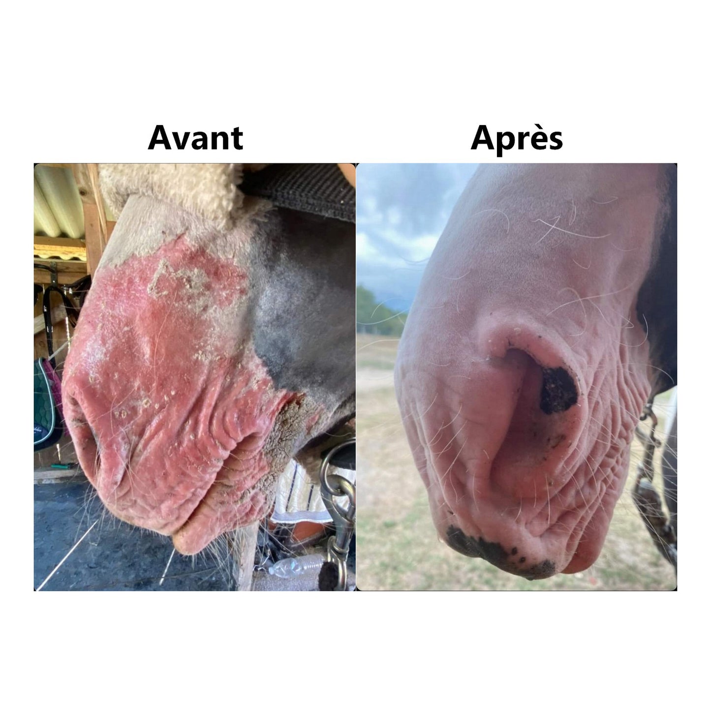 Protection Solaire EKIN – Protection Waterproof Anti-Coup de Soleil