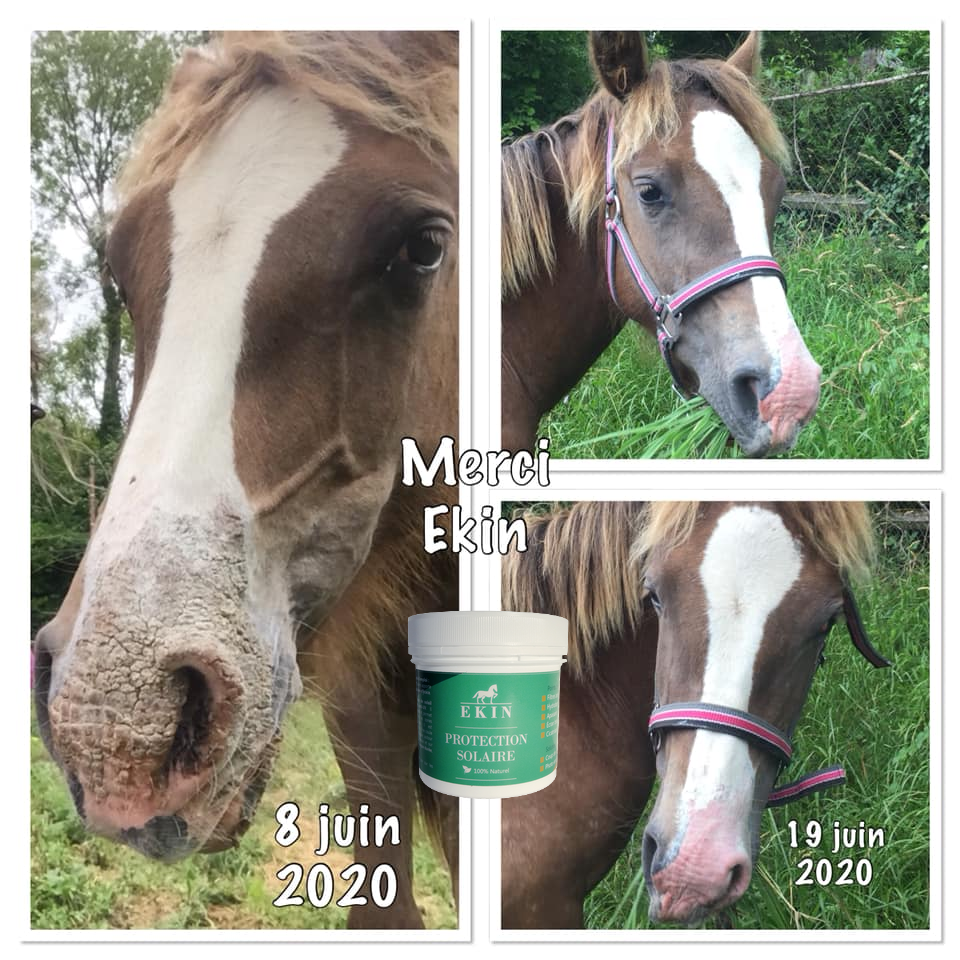 Protection Solaire EKIN – Protection Waterproof Anti-Coup de Soleil